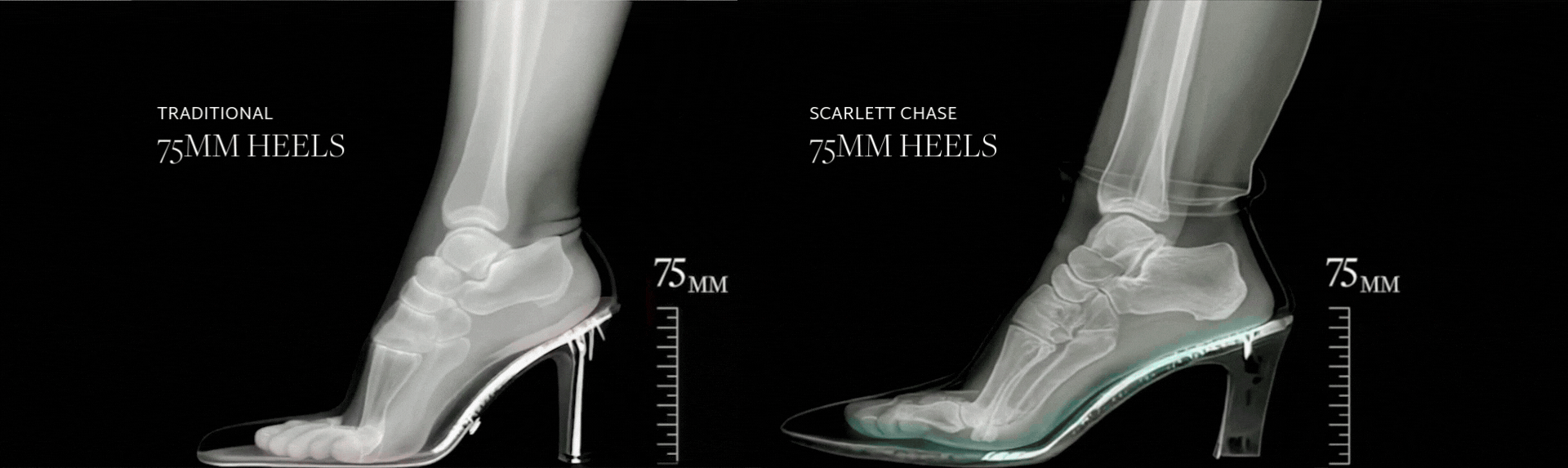 Scarlett Chase Patented Technology - XRay showing how the heels fit